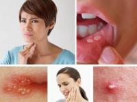 牙龈肿痛消炎的几种方法：外治、敷药与降火法